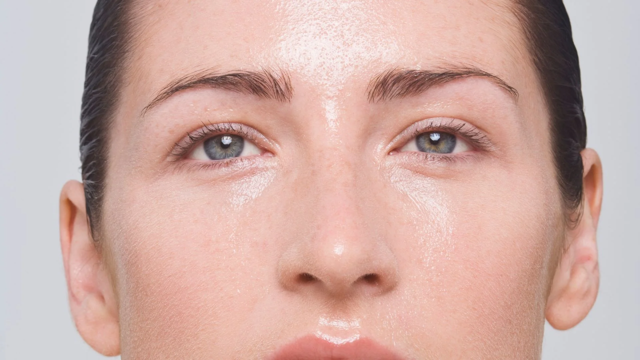 Oily and large pores skin