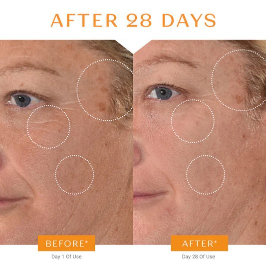 Serum C20 Vitamin C